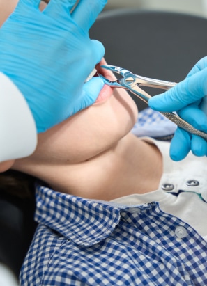 A dentist wearing blue gloves extracts a tooth from a patient dressed in a blue checkered shirt, during a dental procedure.